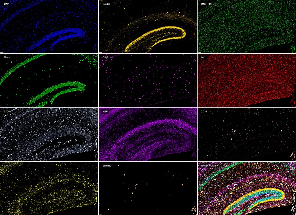 FFPE Mouse Brain 10-plex